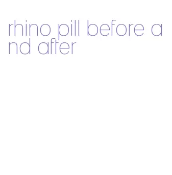 rhino pill before and after